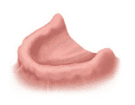 Полная адентия: отсутствие зубов на верхней или нижней челюсти